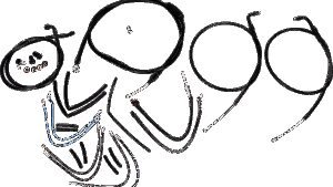 BURLY BRAND Complete Black Vinyl Handlebar Cable/Line Kit for Ape Hangers - 16" - '11-'15 FLS